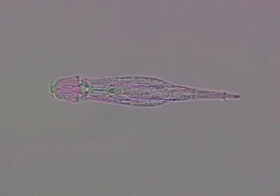 a microscope image of a rotifer